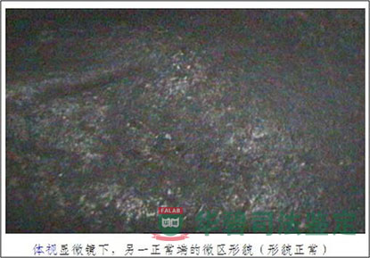 顯微鏡下電弧燒傷點圖1